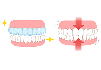 マウスピース治療（スプリント療法）​​